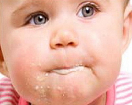 Bebeklerde Yemeklerden Sonra Görülebilen Rahatsızlıklar