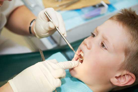 Çocuğunuzun İlk Diş Muayenesini Ne Zaman Yaptırmalısınız