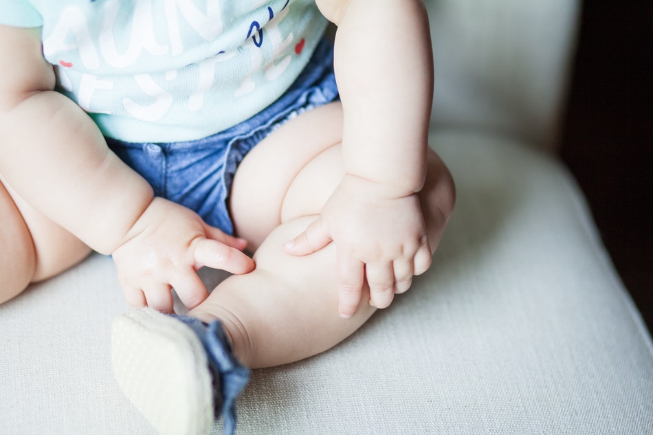 Bebeklerde En Sık Görülen Sendrom Çarpık Ayak