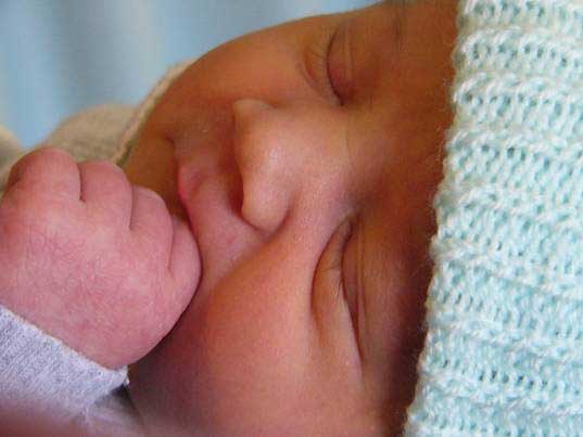 Doğumdan 1 Gün Sonra Yapılan Sünnetin Bebeğinizi Enfeksiyondan Koruduğunu Biliyor Muydunuz