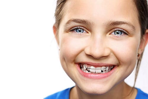 Ortodontik Tedavi Ne Zaman Yapılmalı