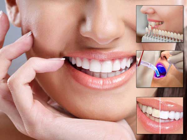 Diş Eksikliği Tedavi Edilmezse Ne Olur